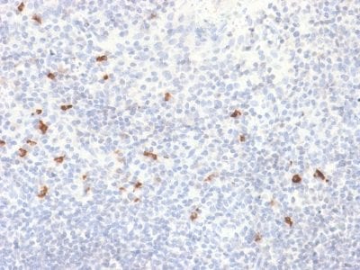 Human IgG4 Recombinant Monoclonal Rabbit Antibody (IGHG4/2042R)