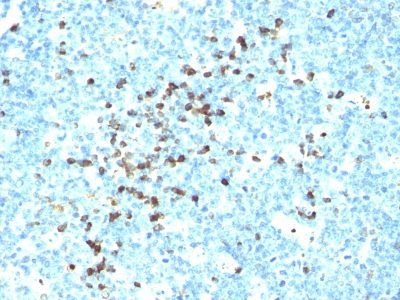 Human IgM Immunoglobulin Monoclonal Mouse Antibody (DA4-4)