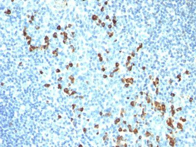 Human IgM Immunoglobulin Monoclonal Mouse Antibody (ICO-30)