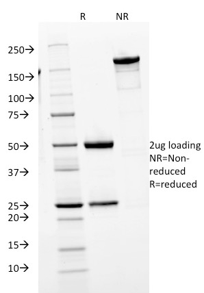 Human IgM Immunoglobulin Monoclonal Mouse Antibody (IGHM/1623)