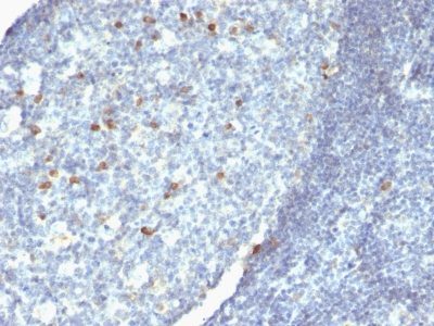 Human IgM Immunoglobulin Monoclonal Mouse Antibody (IM260 + IM373 + ICO-30)