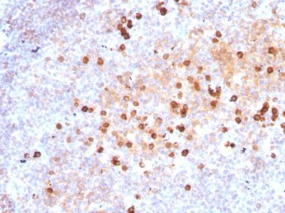 Human IgM Immunoglobulin Monoclonal Mouse Antibody (IM373)