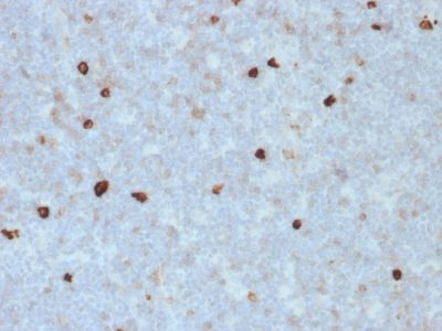 Human IgM Immunoglobulin Monoclonal Mouse Antibody (R1/69)