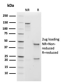 Human IgM Immunoglobulin Recombinant Monoclonal Mouse Antibody (rIGHM/1623)