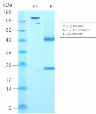 Human IgM Immunoglobulin Recombinant Monoclonal Mouse Antibody (rIGHM/2558)