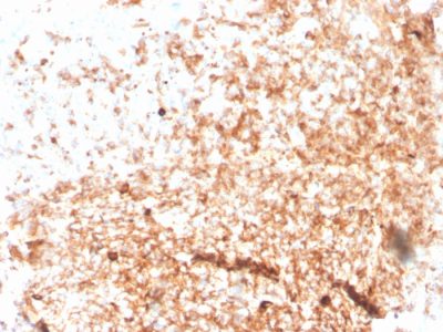 Human IgM Immunoglobulin Recombinant Monoclonal Mouse Antibody (rIGHM/3802)