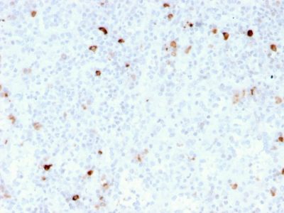 Human IgM Immunoglobulin Recombinant Monoclonal Mouse Antibody (rIM260)