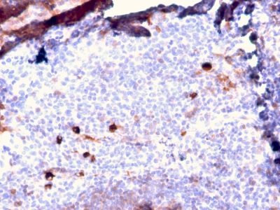 Human IgM Immunoglobulin Recombinant Monoclonal Rabbit Antibody (IGHM/2557R)