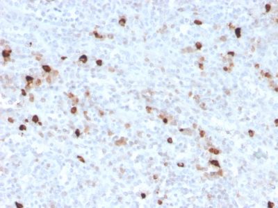 Human IgM Immunoglobulin Recombinant Monoclonal Rabbit Antibody (IGHM/3776R)