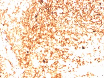 Human IgM Immunoglobulin Recombinant Monoclonal Rabbit Antibody (IGHM/3803R)