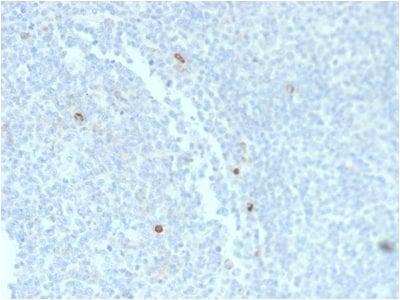 Human IgM Recombinant Monoclonal Mouse Antibody (rIM373)