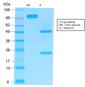 Human IgM Recombinant Monoclonal Mouse Antibody (rIM373)