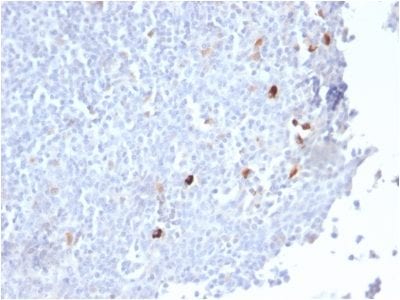 Human IgM Recombinant Monoclonal Rabbit Antibody (IGHM/2559R)