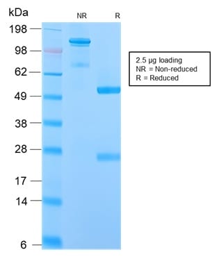 Human IgM Recombinant Monoclonal Rabbit Antibody (IGHM/2559R)