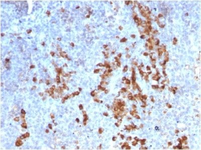 Human Kappa Light Chain / IGKC Monoclonal Mouse Antibody (rKLC709)