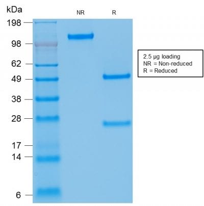 Human Kappa Light Chain / IGKC Monoclonal Mouse Antibody (rKLC709)