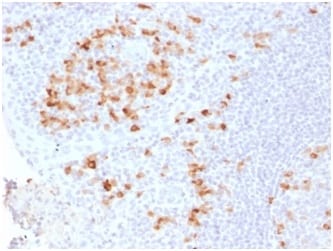 Human Kappa Light Chain / IGKC Recombinant Monoclonal Rabbit Antibody (KLC2289R)
