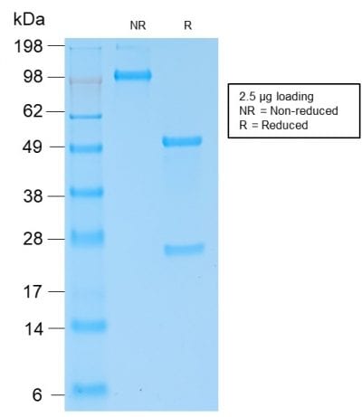 Human Kappa Light Chain / IGKC Recombinant Monoclonal Rabbit Antibody (KLC2289R)
