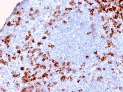 Human Kappa Light Chain / IGKC Recombinant Monoclonal Rabbit Antibody (KLC2886R)