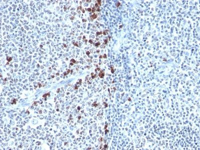 Human Kappa Light Chain Monoclonal Mouse Antibody (HP6053)
