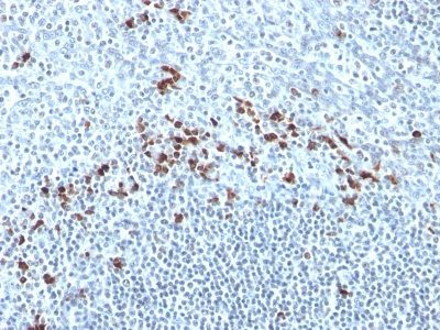 Human Kappa Light Chain Monoclonal Mouse Antibody (Kap-56)