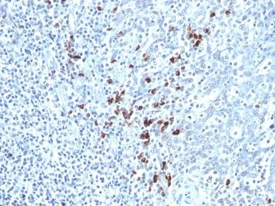 Human Kappa Light Chain Monoclonal Mouse Antibody (KLC264)