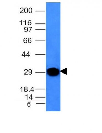 Human Kappa Light Chain Monoclonal Mouse Antibody (KLC264)