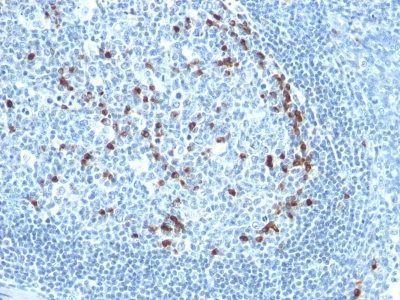 Human Kappa Light Chain Monoclonal Mouse Antibody (KLC709)
