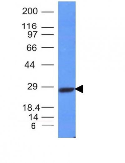 Human Kappa Light Chain Monoclonal Mouse Antibody (L1C1)