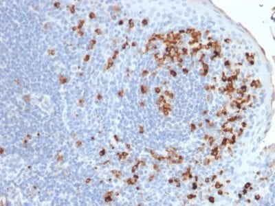Human Kappa Light Chain Recombinant Monoclonal Mouse Antibody (rKLC264)
