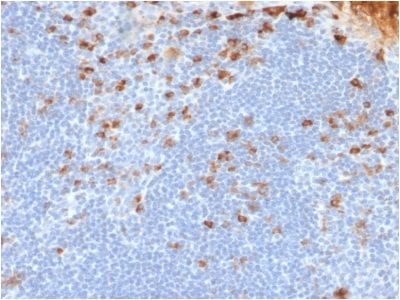 Human Kappa Light Chain Recombinant Monoclonal Mouse Antibody (rL1C1)