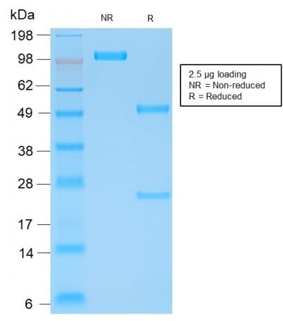 Human Kappa Light Chain Recombinant Monoclonal Mouse Antibody (rL1C1)
