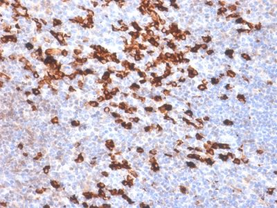 Human Kappa Light Chain Recombinant Monoclonal Rabbit Antibody (IGKC/1999R)