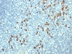 Human Lambda Light Chain Monoclonal Mouse Antibody (HP6054)