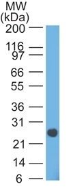 Human Lambda Light Chain Monoclonal Mouse Antibody (HP6054)