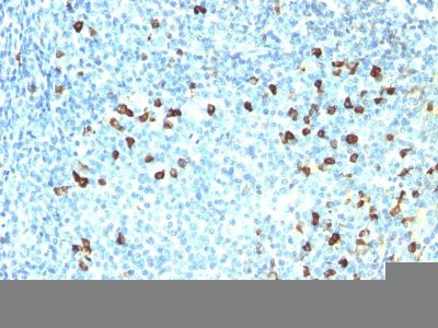 Human Lambda Light Chain Monoclonal Mouse Antibody (ICO-106)