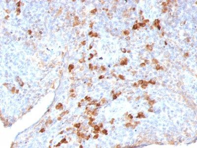 Human Lambda Light Chain Monoclonal Mouse Antibody (LAM03)