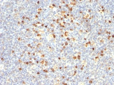 Human Lambda Light Chain Monoclonal Mouse Antibody (Lamb14)