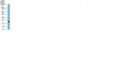 Human Lambda Light Chain Monoclonal Mouse Antibody (Lamb14)