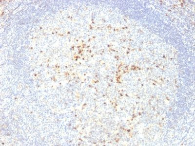 Human Lambda Light Chain Monoclonal Mouse Antibody (LcN-2 + ICO-106)