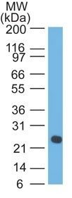 Human Lambda Light Chain Monoclonal Mouse Antibody (LcN-2)