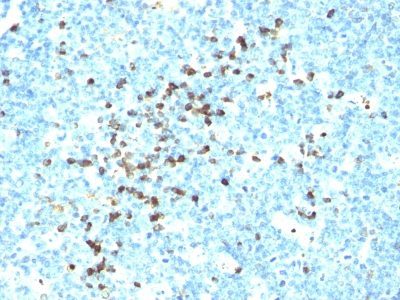 Human Lambda Light Chain Monoclonal Mouse Antibody (LcN-2)