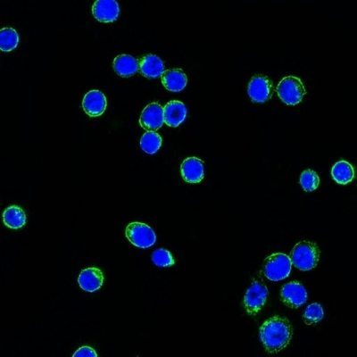 Human Lambda Light Chain Monoclonal Mouse Antibody (LcN-2)