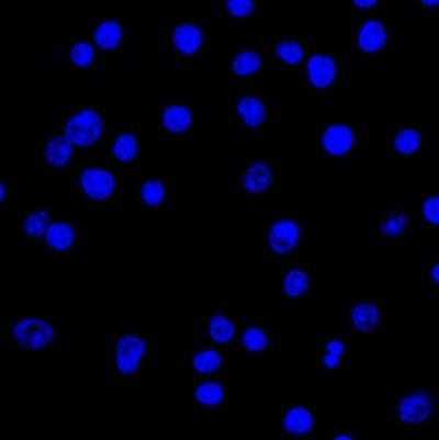 Human Lambda Light Chain Monoclonal Mouse Antibody (LcN-2)