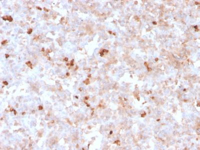 Human Lambda Light Chain Recombinant Monoclonal Mouse Antibody (rLLC/1738)