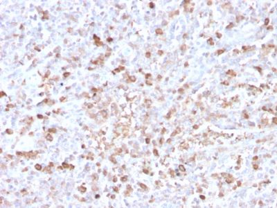 Human Lambda Light Chain Recombinant Monoclonal Rabbit Antibody (LLC/3778R)
