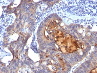 IgA Secretory Component Monoclonal Mouse Antibody (ECM1/792)