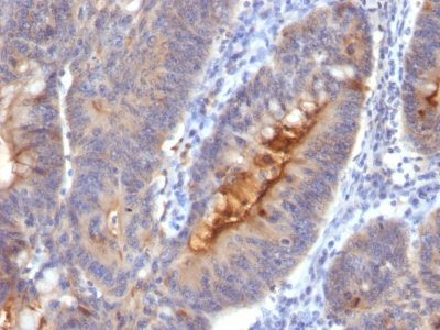 IgA Secretory Component Monoclonal Mouse Antibody (SC05)