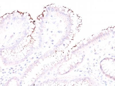 Helicobacter pylori Polyclonal Rabbit Antibody (PAb)