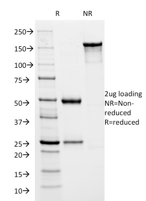 Herpes Simplex Virus 1 (HSV1) ICP8 Monoclonal Mouse Antibody (HSVI/2045)